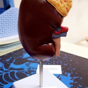 Kidney Model